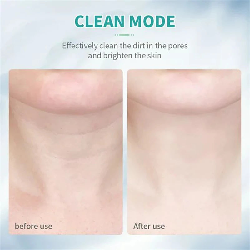 Neck Beauty Slim Massager